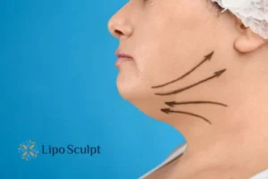 Boost your confidence with a Double chin treatment Leamington Spa 