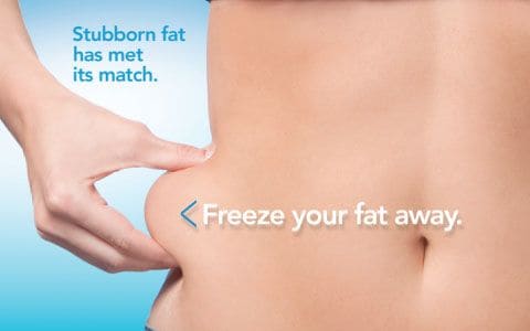 Hips treatment Leamington Spa From Lipo Sculpt