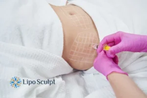Are The Results From Aqualyx Permanent? 1 Do you want to know how long Aqualyx Leamington Spa results last?