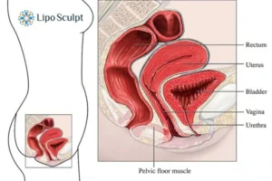 Treatment For A Leaky Bladder 2 How EM Chair treatment Leamington Spa can help Leaky bladder issues. Read more now!