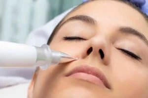 Actinic keratoses Leamington Spa solutions - book in today!