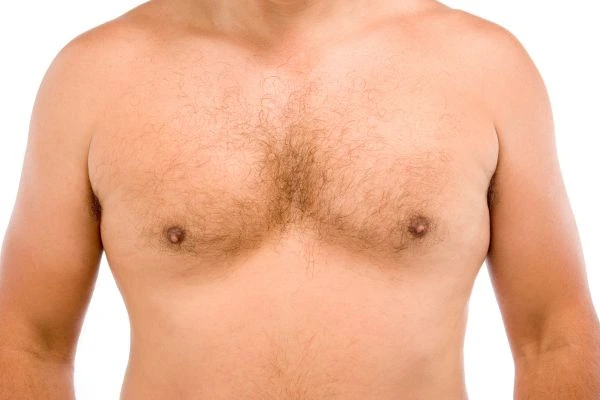 Fat freezing for moobs reduction treatment Leamington Spa book in today!